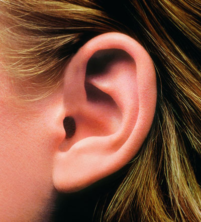 ear1